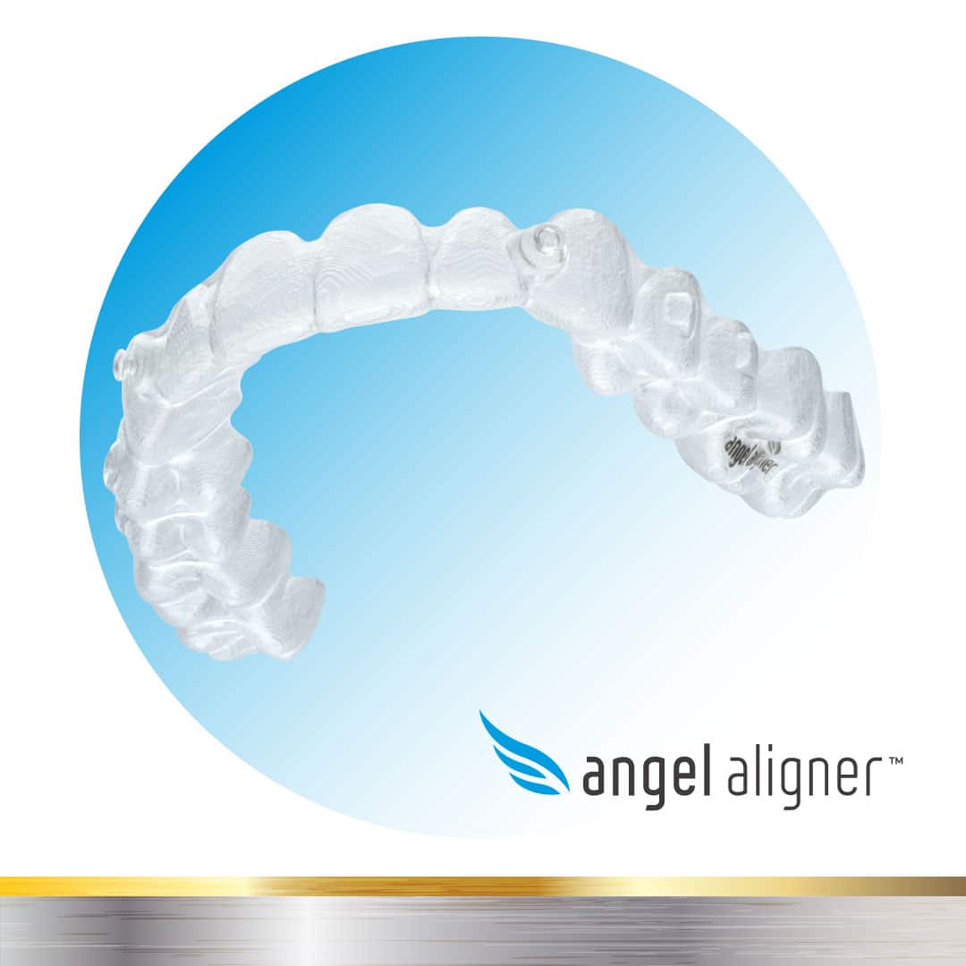 All About Clear Aligners - Orthodontist Vancouver WA Clear Aligners ...